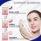Blemish Cream Spots Removal Treatment Pimple Ointment Scar Mark