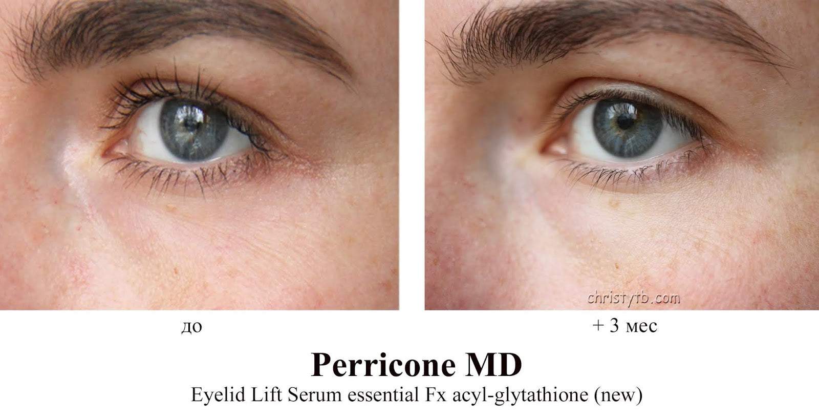 Perricone MD Essential FX Eyelid Lift Serum